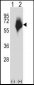 MMP2 Antibody (Center)
